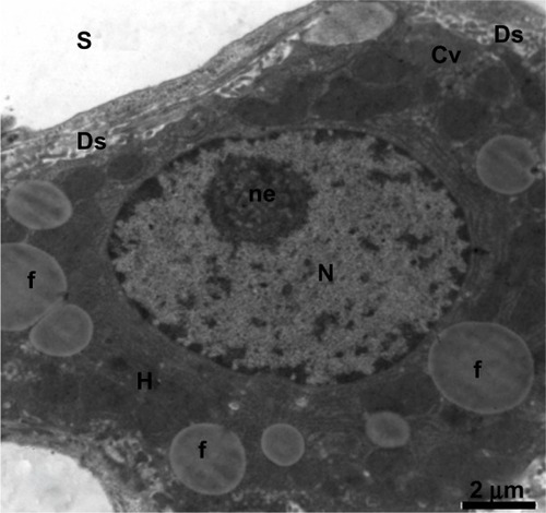 Figure 15 Transmission electron micrograph of a hepatic cell from the treated group containing numerous fat globules and a nucleus with hypertrophied nucleoli. Notice the presence of cytoplasmic vacuolization, the sinusoidal lumen, and Disse’s spaces. Scale bar 2 μm.Abbreviations: Cv, cytoplasmic vacuolization; Ds, Disse’s spaces; f, fat globules; H, hepatic cell; N, nucleus; ne, nucleoli; S, sinusoidal lumen.