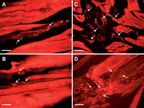 Figure 2. Fluorescence photomicrographs of sections from gastrocnemius muscles immunohistochemically stained for neuronal markers and labeled with fluorochrome Cy3. CGRP-positive nerve fibers in control (A) and experimental (B) sides in group I; PGP 9.5-positive nerve fibers in experimental side in group II (C), and SP-positive nerve fibers in experimental side in group III (D). Arrows indicate nerve fibers. Bar represents 50 μn.