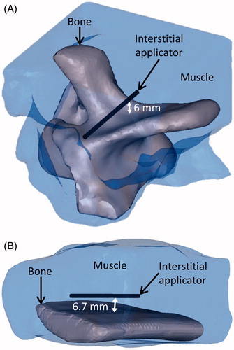 Figure 10. 3D objects that were meshed to model the bovine vertebra (A) and bovine rib (B) ablations monitored by MR thermometry.