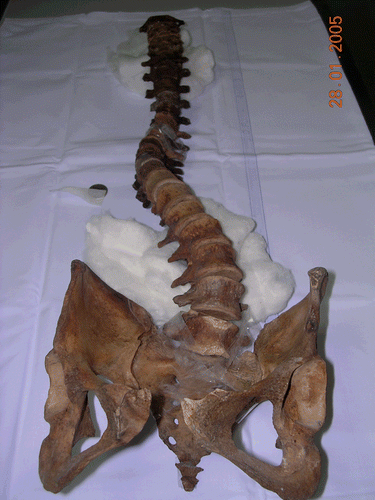 Figure  2.  The backbone of Giovanna of Austria (Progetto Medici 2004. By accomplishment of Soprintendenza Speciale Polo Museale Fiorentino).