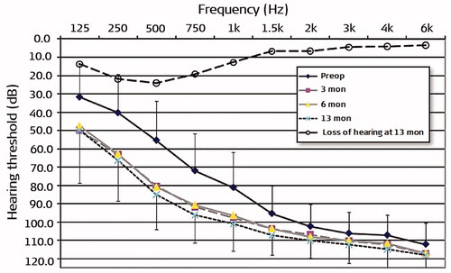 Figure 49. Mean audiograms of the implanted ear at four testing time points (pre-op and post-op at 3, 6, and 13 months). Error bars depict standard deviations [Citation51]. Statistical test: ANOVA two-factor-without-replication test was used for comparison of hearing thresholds at various time points (p < .05). Reproduced by permission of Taylor and Francis Group.