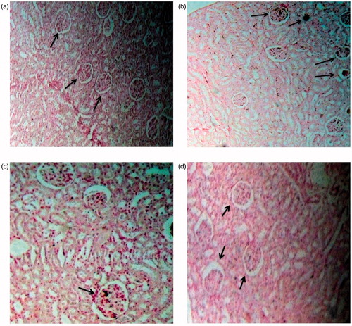 Figure 4. Light microscopic architecture and calcification in the kidney section with Pizzalato stained: ×100 of (A) control, (B) nephrolithic, (C) prophylactic treatment with cystone (300 mg/kg), and (D) prophylactic treatment with extract of B. ciliata (300 mg/kg).