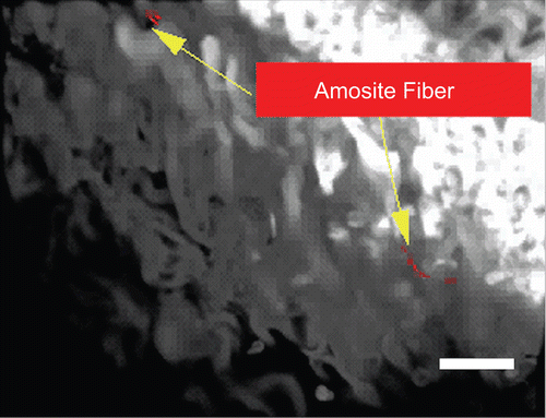 Figure 17.  Confocal image of the amosite-exposure group at 7 days after cessation of exposure. Amosite fibers with an accompanying macrophage inflammatory response are seen already. The micron bar in the lower right corner is 10 µm in length.