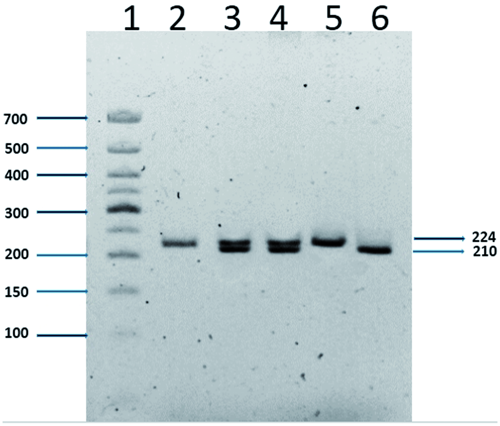 Figure 3. Detection of 14-bp deletion/insertion polymorphisms using electrophoresis. Lane 1: 50-bp ladder; lanes 2 and 5: homozygote for insertion; lanes 3 and 4: heterozygote; lane 6: homozygote for deletion. The figure shows a representative gel. Values to the right indicate the molecular weights of the PCR products (224 or 210 bp) depending on insertion or deletion of the 14 bp in exon 8.