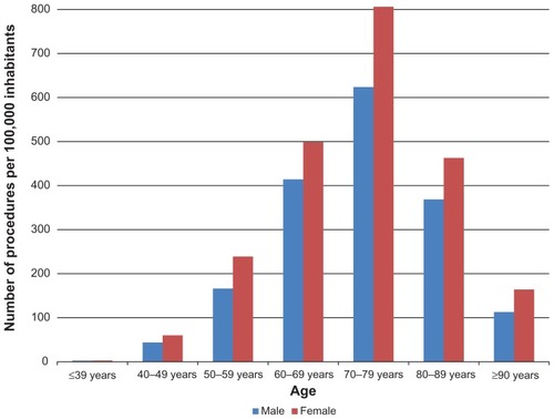 Figure 2 Incidence rates of primary knee arthroplasty procedures per 100,000 inhabitants (on y-axis) in Denmark according to specific age and sex (on x-axis).