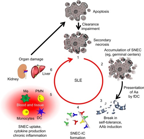 Figure 2 The vicious cycle of SLE.Notes: A deficiency in the clearance of apoptotic cells leads to autoimmunity and chronic inflammation (1). when apoptotic cells fail to be cleared in time, they get secondary necrosis, leading to the accumulation of SNEC (2). Self-tolerance is broken when SNEC-derived autoantigens (Aag) are presented to autoreactive B cells by fDC. with help from autoreactive helper T cells, these B cells undergo affinity maturation and differentiate into memory B cells, thus establishing autoimmunity (3). IC are formed when autoantibodies (AAb) encounter SNEC in circulation or tissue (4). Newly formed SNEC-IC are then processed by blood-borne phagocytes and dendritic cells (DC) accompanied by the secretion of pro-inflammatory cytokines (5). This in turn leads to severe organ damage and cell death fueling the vicious cycle that maintains chronic inflammation (6).Abbreviations: SNEC, secondary necrotic cell-derived material; fDC, follicular dendritic cells; IC, immune complex; SLE, systemic lupus erythematosus; DC, dendritic cells; MΦ: macrophage, PMN: polymorphonuclear leukocytes.
