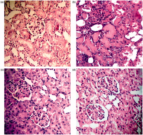Figure 7. Histopathological changes in the therapeutic study groups. (a) T1: Normal control group showing a section of normal kidney (H&E staining; 400×). (b) T2 ARF model group showing more than 70% necrotic cortical tubules with many casts (H&E; 400×). (c) T3 ABE (100 mg/kg/day)-treated group showing about 30% necrotic tubules with casts (H&E; 400×). (d) T4 ABE (200 mg/kg/day)-treated group showing about some necrotic tubules (H&E; 400×).