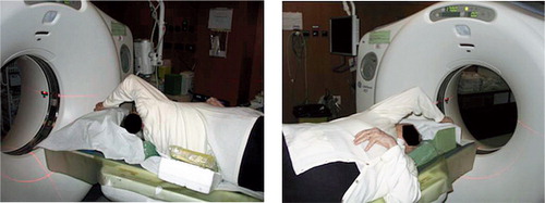 Figure 2. Position of the patient in the CT scanner as used in this study: patient in lateral decubitus or in three-quarter decubitus, allowing the scapula to tilt, with shoulder in maximal flexion.