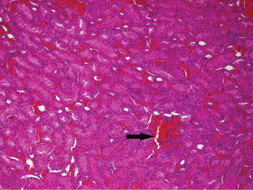 Figure 6. The histopathological examination of the renal tissue of renal ischemia (RI) group. Hemorrhage (arrow), but no tubular injury, was observed in interstitial area.