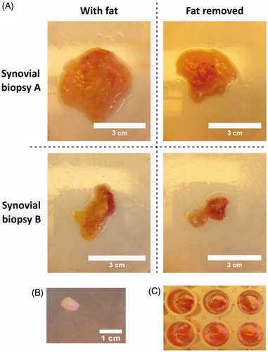 Figure 3. Preparation of synovial biopsies to synovial membrane explants. (A) When synovial biopsies are received from the hospital the fat is initially removed with a scalpel. Here are two biopsies from two different patients (A and B) showed before and after the fat was removed. Scale is 3 cm. (B) Small explants of 30 ± 2 mg are cut with the scalpel and the wet weight determined after the fat is removed. Scale is 1 cm. (C) Cut explants are transferred directly to a well containing culture media. Before start of the experiment the explants are washed 3 times in culture media.