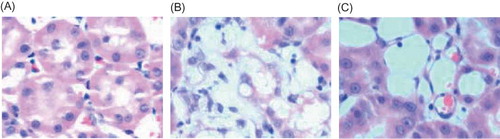 Figure 1. Hematoxylin–eosin staining in rat renal tissue samples at week 21 (×400). (A) There was no significant histological abnormality in the control group. (B) Degenerated, necrotic, and sloughed tubule epithelial cells and an exposed basement membrane were seen, and some of the tubule structures were atrophied and lost. (C) In Cozaar group, only local mild tubular epithelial lesions were observed.