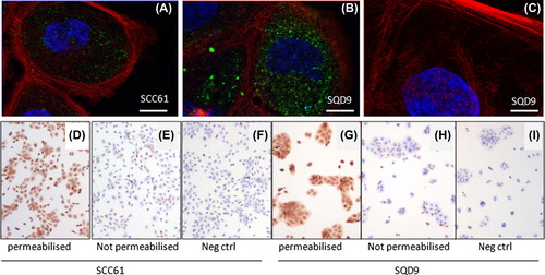Figure 4. FLT1 has an intracellular localisation. (A–C) Merged colour confocal microscopy images taken from SCC61 (A) and SQD9 (B). FLT1, shown in green is located intracellularly. Fiber-actin (Phalliodin-Alexa555) and nucleus (To-Pro3) are shown in red and blue, respectively. (C) FLT1 negative control staining where only a secondary Alexa 488 coupled Fab fragment was used. Scale bars 10 μm. (D–I) Classical immunocytochemistry using a FLT1 antibody against the extracellular part of the FLT1 receptor (40×). SCC61 (D) and SQD9 (G) show strong immunoreactivity when cells are permeabilised with Tween. However, when Tween permeabilisation is avoided, immunoreactivity in SCC61 (E) and SQD9 (H) becomes comparable to their respective negative controls (F, I).