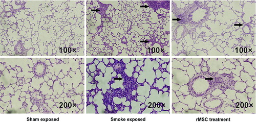 Figure 3.  rMSC infusion reduced inflammation of peribronchial and alveolar structures. Pulmonary histopathological changes were observed by hematoxylin and eosin staining. The arrows indicate airway and lung inflammation in smoke-exposed rats and reduced inflammatory cells in peribronchial and alveolar structures after rMSC administration.