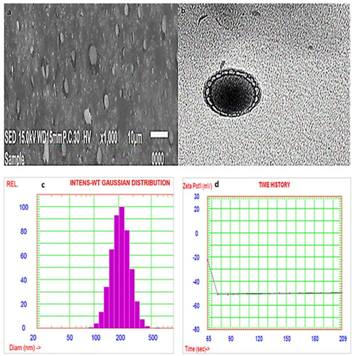 Figure 10 Scanning electron micrograph (A), transmission electron micrograph (B), particle size distribution curve (C) and zeta potential (D) of the optimized AKBA-loaded SNVs.