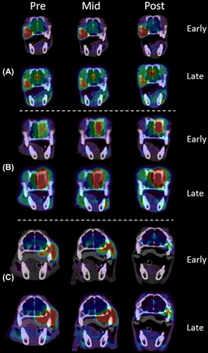 Figure 3. FDG-PET/CT images of patients A–C taken pre-, mid- and post-therapy. Images acquired in the early (0–2 min p.i.) and late (40–45 min p.i.) phase of the dynamic acquisition are shown. The SUV window was [0.5, 6].