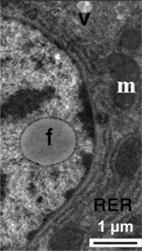 Figure 16 Transmission electron micrograph of a hepatic cell from the treated group showing intranuclear fat globules in the nucleoplasm. Note the well-developed cisternae of the rough endoplasmic reticulum, and the few mitochondria and small membranous vesicles. Scale bar 1 μm.Abbreviations: f, fat globules; m, mitochondria; RER, rough endoplasmic reticulum; v, membranous vesicles.