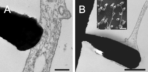 Figure 5.  TEM images show that astrocytes make very close contact to the pillars with a distance in the nm range (A and B). SEM image (insert in B) shows that nanotubes end on pillars in a bulb-like contact. Scale bars in A and B represent 200 nm and 1 µm (insert: 2 µm), respectively. Nanostructures were gold.
