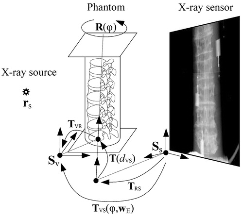 Figure 2. X-ray image acquisition.