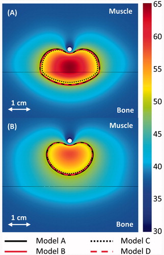 Figure 4. 240 CEM43 °C contours calculated with models A–D after a 10-min ablation are shown in the central plane between the two transducers. The applicators (white circle) are placed 1 and 2 cm from a flat bone (black line) in A and B, respectively. A colour map shows the temperatures (°C) calculated with the constant transmission volumetric model (model B).
