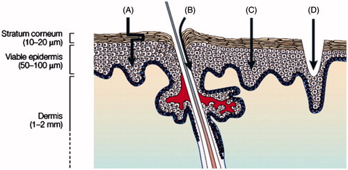 Figure 1. Cross section through human skin (A) intracellular, (B) hair follicles and sweat glands, (C) direct pathway through the SC and, (D) depicts the micron sized holes that can be created by MNs upon the skin (modified from Shah et al. (Citation2011)).