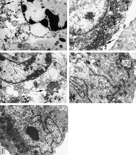Figure 2.  Electron microscopy of five cell lines infected with BTV-10 36 h post infection. All of sections were stained with uranyl acetate and Reynold lead citrate. N stands for nucleus and the arrow shows the amplified virions. A. Hep-3B (×12 000), B. A549 (×20 000), C. NIH 3T3 (×15 000), D. HEL (×12 000) and E. MEF(×8 000).