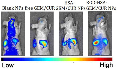 Figure 6 The in vivo imaging of DiR-loaded Blank NPs; free GEM/CUR, HSA-GEM/CUR NPs and RGD-HSA-GEM/CUR NPs in tumor bearing nude mice at 12 h (n=3).