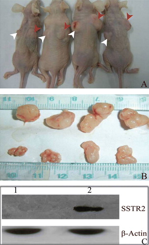 Figure 5.  Overexpression of hSSTR2 inhibited the growth of human pancreatic tumors. The intratumoral injection of the Adv-SSTR2 in the capan-2 xenografts resulted in marked inhibition of the tumor growth. A: Adv-SSTR2 were injected into the capan-2 xenografts (indicated with white arrows) while Adv-LacZ was injected into the controls (indicated with red arrows). B: The tumor tissues, Adv-LacZ transfected (upper panel) and Adv-SSTR2 transfected (lower panel), were excised and measured four weeks after the last injection. C: The overexpressed SSTR2 was detected in capan-2 xenografts transfected with Adv-SSTR2 (lane 2) but not in Adv-LacZ transfected controls (lane 1), shown by Western Blot assay (lane 2) while it was using anti-SSTR2 and HRP-conjugated secondary antibody. The endogenous β-actin was used as a control.