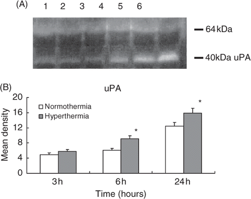 Figure 6. Casein/plasminogen zymogram shows the activities of uPA and tPA in the ischaemic injured brain collected from normothermic and hyperthermic rats. Lane 1: 3 h after normothermia; lane 2: 3 h after hyperthermia; lane 3: 6 h after normothermia; lane 4: 6 h after hyperthermia; lane 5: 24 h after normothermia; lane 6: 24 h after hyperthermia. The upper band with a molecular weight of 64 kD represents tPA and the lower band with molecular weight of 40 kD represents uPA (A). Histogram shows the pooled data of uPA activities in the infarcted brain tissue (B). *p < 0.05 compared with the normothermic group.