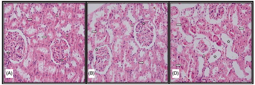 Figure 1. Light microscopic micrographs of rat kidney sections stained with H&E from control (A), sham (B), and experimental (D) groups. (A) Structure of kidney glomerular (star), proximal (right arrow) and distal tubule (arrowhead) with normal histological structure in the histological sections of the control group. (B) Structure of kidney glomerular (star), proximal (right arrow), and distal tubule (arrowhead) with normal histological structure in the histological sections of the sham group. (D) Atrophic glomeruli (arrowhead), tubular enlargement (star), disorganization in proximal and distal tubular epithelial cells (right arrow), tubular epithelial cell loss (left arrow).