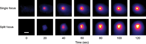 Figure 6. Representative IR heating images for treatment of planar phantoms with single focus and split focus transducers, for a 120s exposure with each device. Images at early time points for the split focus device allow individual foci to be observed, which eventually meld together into a single larger focal spot (compared to the single focus device) by the end of the exposure. (Scale bar = 1 cm).