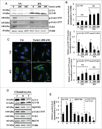 Figure 5. Autophagy in NP cells is regulated in an MTOR-independent fashion. (A) Western blot analysis of NP cells cultured under normoxia (NX) or hypoxia (HX) for 24 h, with or without Torin1 (200, 400 nM). LC3-II level is increased by hypoxia, but unaffected by Torin1 treatment. The p-ULK1 Ser757 level is significantly reduced with Torin1 treatment, confirming MTOR-dependent phosphorylation of ULK1 is successfully inhibited. The level of p-ULK1 Ser777 as well as total ULK1 is also reduced by Torin1, indicating Torin1 also affects MTOR function in protein synthesis. (B) Densitometric analysis of multiple independent western blot experiments confirms that inhibition of MTOR-dependent phosphorylation of ULK1 has no effect on LC3-II levels under both normoxia and hypoxia. (C) Immunofluorescence staining of endogenous LC3 demonstrates Torin1 has no effect on the number of LC3-positive autophagosomes in NP cells. Scale bar: 25 μm. (D) Western blot analysis of chondrocytes treated with either rapamycin (500 nM) or Torin1 (400 nM) for 6 h demonstrates increased LC3-II levels and concurrent decreased SQSTM1 levels. Both rapamycin and Torin1 blocked MTOR phosphorylation of ULK1 at Ser757. (E) Densitometric analysis of multiple independent western blot experiments confirms that modulation of MTOR activity alters the level of autophagy in chondrocytes. All the quantitative data are represented as mean ± SE from at least 3 independent experiments. NS, nonsignificant, Ctr/C, control; R, rapamycin; T, Torin1; *, p < 0.05.