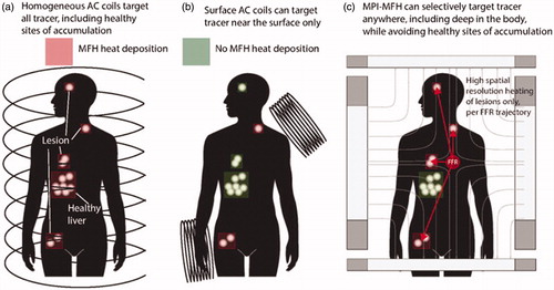 Figure 5. Comparison of MPI–MFH among other magnetic hyperthermia techniques: (a) Whole body MFH will heat all locations where MNPs are accumulated including healthy tissue; (b) Surface coils can be used to target surface tumors but not sites deep in the body; (c) MPI–MFH can target any site in the body using the FFR, including those deep in the body with high resolution [Citation21]. (Reproduced with permission from Hensley et al., 2017 Physics in Medicine & Biology, IOP Publishing [Citation21]).