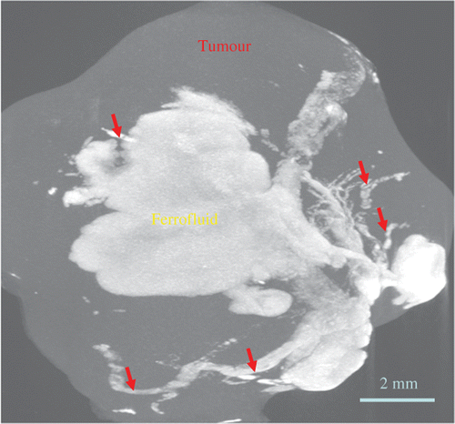 Figure 6. An obtained 3-D microCT scan image of a tumour with nanoparticle injection after the heating experiment. Red arrows represent ferrofluid filled cracks/voids within the tumour.
