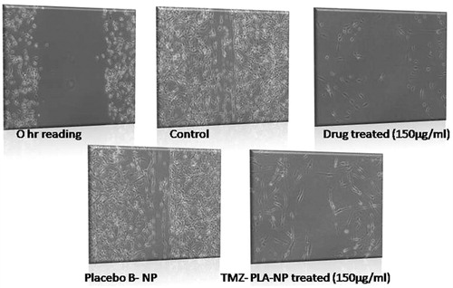 Figure 10. Wound scratch assay performed on U-87 MG cells for pure drug, TMZ-loaded PLA nanoparticle formulation and placebo formulation. Anti-metastatic activity was demonstrated by the developed nanoparticles similar to the pure drug.