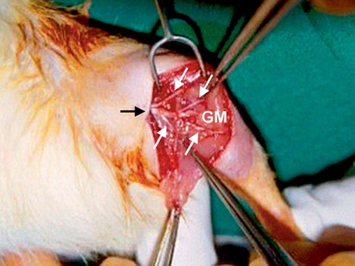 Figure 1. Intraoperative photograph of the right leg of a rat from group III showing the sural nerve (black arrow) split into 4 fascicles (white arrows) and embedded into 4 arbitrarily divided quadrants of the lateral head of the gastrocnemius muscle (GM).