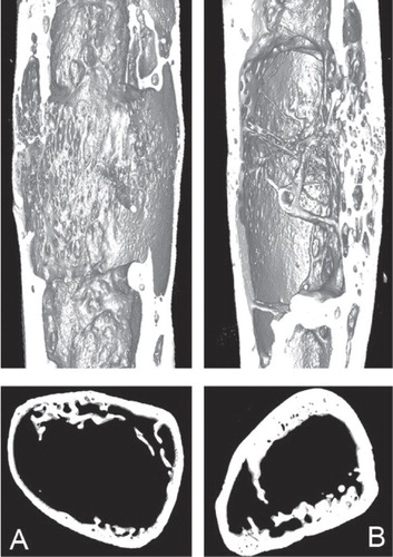 Figure 3. Micro-CT images of the distraction callus. Group R (A) had significantly thinner cortical bone and less bone formation than group I (B).