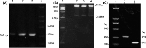 Figure 1. Gel electrophoresis images. (A) PCR was performed using the Adeno-X forward PCR primer and reverse PCR primer; (B) Plasmids of recombinant adenoviral vector were digested with enzyme PI-Sce I and I-Ceu I followed by electrophoresis on agarose gel. 1-DNA ladder; 2,3,4-the products of digestion; (C) After co-transfection of BMSCs, the expression of BMP-2 induced by DOX, was verified by RT-PCR. 1-DNA ladder; 2-BMP-2; 3-β-actin.