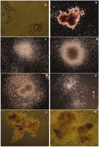 Figure 1. Observed colonies in the methylcellulose-based clonogenic assay – after 14 days. (A) CFU-E (200×): An isolated single colony containing ≈8–200 erythroblasts. (B) BFU-E (20×): > 200 erythroblasts in a single or multiple clusters. (C–F) CFU-GM (20×): An aggregate containing at least ≥50 granulocytes (CFU-G), macrophages (CFU-M), or cells of both lineages. (G, H) CFU-GEMM (100×): > 500 cells containing erythroblasts and cells of at least two other recognizable lineages.