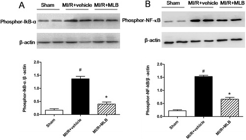 Figure 6. Effect of MLB on protein expression of phosporylation of IkB-α and NF-κB in MI/R injury rats. (A) Phosporylation of IkB-α was analyzed by western blot. Graphs showing the protein ratio of phospor-IkB-α/β-actin. (B) Phosporylation of NF-κB was analyzed by western blot. Graphs showing the protein ratio of phospor-NF-κB/β-actin. MI/R, myocardial ischemia/reperfusion; MLB, magnesium lithospermate B. Values are expressed as the mean ± S.D. Significance was determined by ANOVA followed by Tukey’s test. # p < 0.05 versus Sham group; *p < 0.05 versus MI/R + vehicle group.