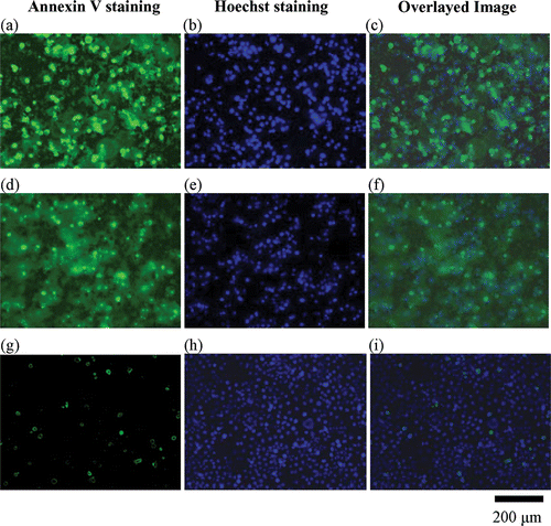 Figure 4. Images of fluorescent staining of Annexin V, Hoechst and overlay in Chago-K1 cells following 24 h treatment of different TiO2 concentrations. Cell nuclei were stained light blue by Hoechst dye in the untreated control group but appeared rounded and brightly fluorescent in the treated groups. The green Annexin V staining clearly labelled cell membrane confirming translocation of phosphatidylserine from the inner to outer leaflet of cell membrane. (a)–(c) Treatment of 1 mg mL−1 TiO2 in Chago-K1 cells. (d)–(e) Treatment of 0.3 mg mL−1 TiO2 also revealed significant increase in Annexin V and Hoechst staining compared to the control (no nanoparticles) (g)–(i).