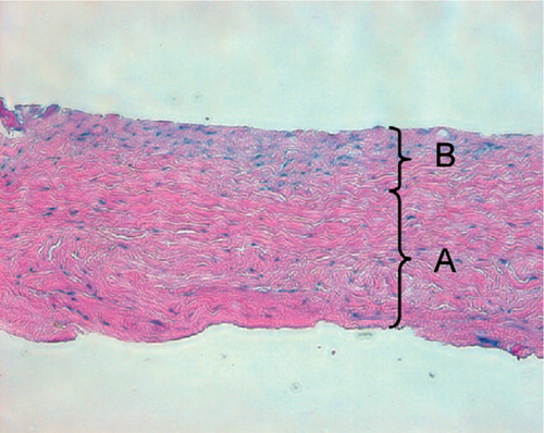 Figure 1. Typical microscopic appearance of the harvested periosteum. The periosteum contains two distinct layers: (A) a thick, outer fibrous layer, and (B) a thin, inner cambium layer which is adjacent to the bone (hematoxylin and eosin, × 200).