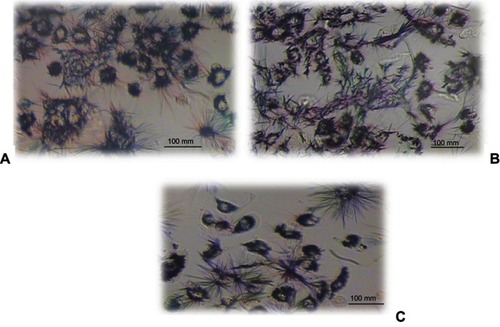 Figure 9 Morphology of the human epithelial cell lines (A549) after incubation with Nano-curcumin for 24 hrs (original magnification, 100×). (A) Control, (B) Nano-curcumin 1,000 µg/mL, (C) Nano-curcumin 200 µg/mL.