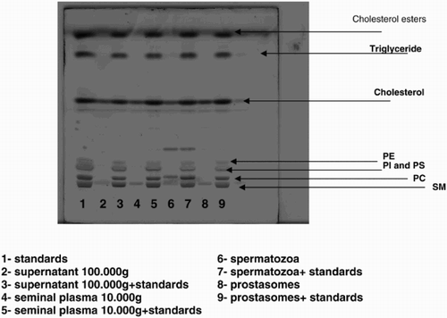 Supplemental Figure 3.  Lipid analysis of different fractions in the absence or presence of lipid standards. A new HPTLC plate on which different samples were spotted, is presented in order to explain the non alignment of the lipid classes of the samples with the standards in Figure 4b which is due to the fact that the standards used in our experiments were from various sources. The fatty acid composition (molecular species) of the subclasses (PC = Phosphatidylcholin; PE = Phosphatidylethanolamin; SM = Sphingomyelin; PI = Phosphatidylinositol; PS = Phosphatidylserin) of phospholipids of the standards was different from the composition of the subclasses of phospholipids extracted from human spermatozoa which explains the shift observed for some of the bands. Lanes 2, 4, 6, and 8 correspond to supernatant 100,000g; seminal plasma 10,000g; spermatozoa, and prostasomes. Lane 1 corresponds to the standards alone. Lanes 3, 5, 7, and 9 correspond to the same samples as the ones plated as lanes 2, 4, 6, and 8 with the difference that in each of them standards were added. When comparing lane 2 with lane 3, lane 4 with lane 5, lane 6 with lane 7, and lane 8 with lane 9, we can see that the bands corresponding to SM and PC are not necessarily at the same level and that a shift could be observed for some of the samples. This discrepancy is due to the difference of molecular species of phospholipids subclasses from standards versus samples.