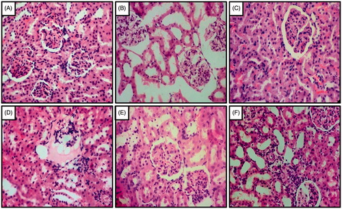Figure 3. Effect of captopril and FLC on DOCA-salt induced alteration in kidney histology of rats. Photomicrograph of sections of kidney of (A) UNTZD control rats showed normal glomerulus cell and tubuli with the absence of any congestion, (B) UNTZD + DOCA-salt control group showed atrophy of tubular cell, necrosis and glomerulus congestion, (C) UNTZD + DOCA-salt + captopril (30 mg/kg) showed decrease in glomerulus congestion, atrophy and necrosis, (D) UNTZD + DOCA-salt + FLC (200 mg/kg) showed no significant protection against hypertension, (E) UNTZD + DOCA-salt + FLC (400 mg/kg) showed decrease in glomerulus atrophy, congestion and necrosis, and (F) UNTZD + DOCA-salt + FLC (800 mg/kg) showed significantly reduced glomerulus congestion and necrosis. Hematoxylin and eosin staining (at 40×).
