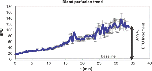 Figure 3. The increase of blood perfusion in a tissue undergoing a power delivery of typically 75 W.