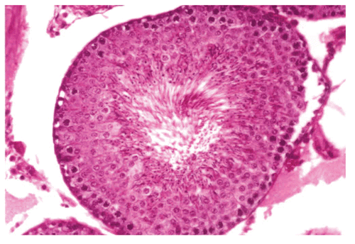 Figure 6.  Showing the section of Rat testis after the recovery period of 120 days.