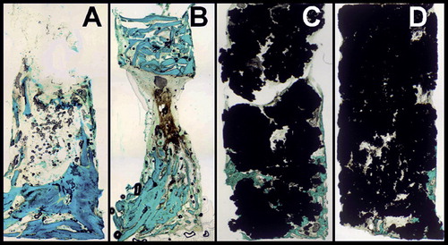 Figure 2. Shape of the bone ingrowth front in empty chambers (A), allograft with graft remnants at the top (B), non impacted, coated titanium particles (C), and coated, impacted titanium particles (D) (Goldner staining).