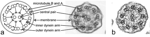 Figure 3 a. Schematic diagram of a cilium cross‐section (left). b. Electron micrograph of a cilium cross‐section from a healthy proband analyzed by transmission electron microscopy. Please note outer dynein arms are visibly attached at almost all nine peripheral doublets. In contrast, inner dynein arms are visible only on a few peripheral doublets (arrow). c. Transmission electron micrograph of a cross‐section from a respiratory cilium originating from a patient carrying DNAH5 mutations shows absence of outer dynein arms.