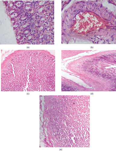 Figure 2.  Hematoxylin and eosin immunohistochemical staining of gastric ulcers after ulcer induction in rats. (a) Intact mucous membrane in control treated rat showing granular tissues composed of macrophages, fibroblasts, and endothelial cells forming microvessels. (b) Congestion of mucosal blood vessels observed in diclofenac treated group. (c–e) No damage to mucosa of rats treated with test compounds 7a, 7b, and 7c, respectively. These specimens were identical to that of the control (a). Original magnification ×200.