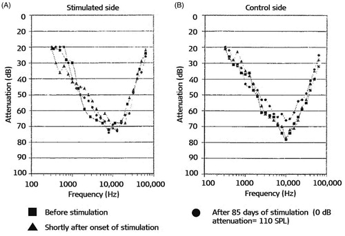 Figure 5. CAP audiograms in normal-hearing non-human subjects before and after chronic electric stimulation: square points refer to the time before stimulation, triangle points refer to the time shortly after the onset of stimulation, and circle points refer to 85 days after stimulation, for both stimulated and the control ear. No major differences were identified between the two ears [Citation4]. Reproduced by permission of Karger AG, Basel.